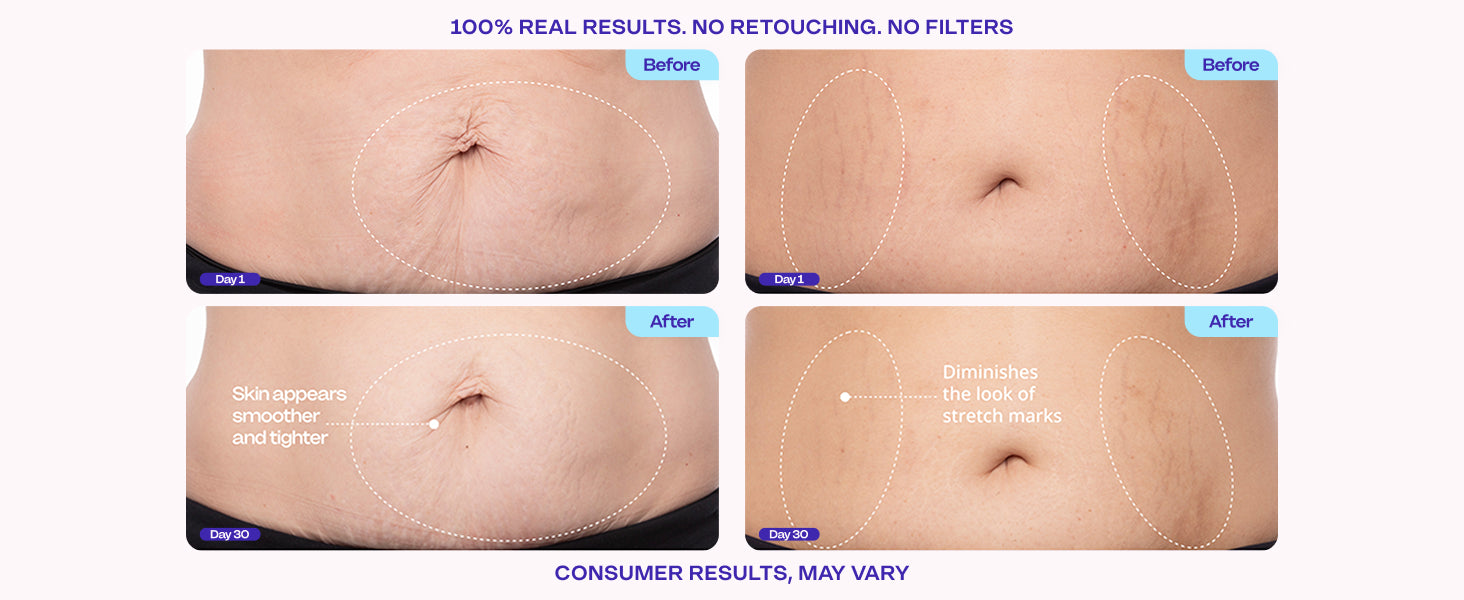 Advanced Firming Body Cream – Tightens, Lifts & Smooths Skin on Belly, Arms, Thighs & Neck