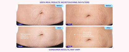 Advanced Firming Body Cream – Tightens, Lifts & Smooths Skin on Belly, Arms, Thighs & Neck